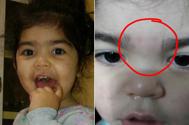 Moms claim daycare workers waxed their kids’ eyebrows